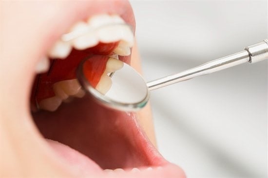 A little dentist mirror in an open mouth
